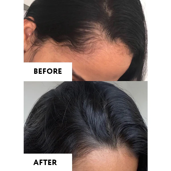VELLO Hair Fertilization Therapy ALFA-LACTOBABY® | Hair Growth 90ml / 3fl.oz - YBERA PARIS - Image 7